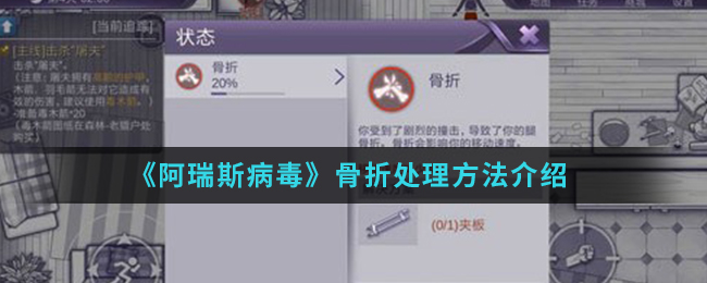 《阿瑞斯病毒》骨折处理方法介绍